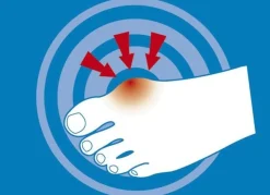 epitact Epithelium 26® Hallux valgus-Schutz