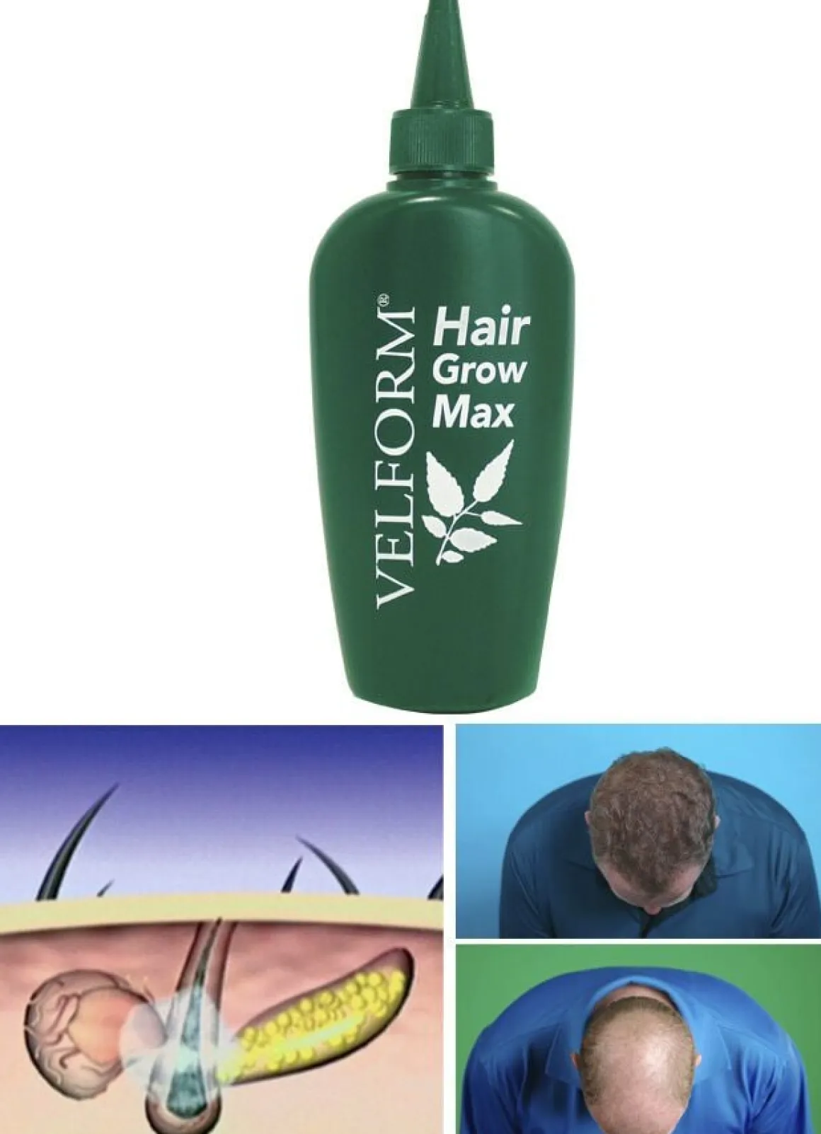 "VELFORM Hair Grow Max" Haarwasser
